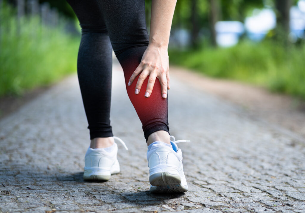 edema swelling in legs