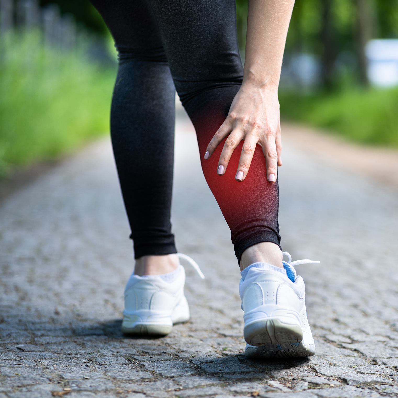 Varicose Vein Symptoms