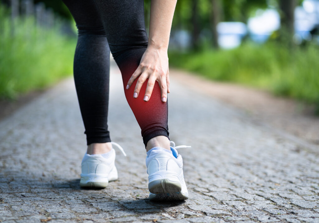 Superficial Thrombophlebitis