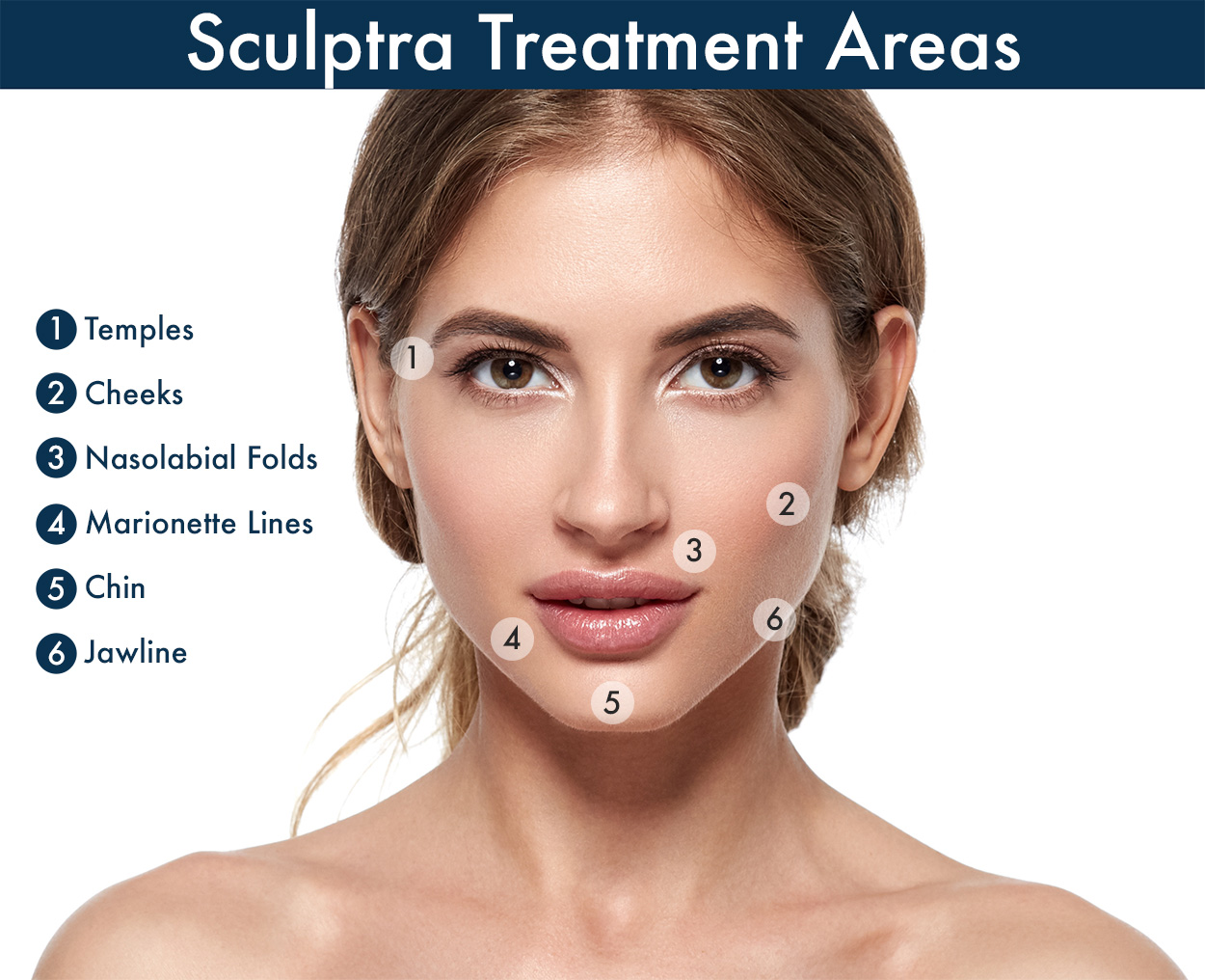 Sculptra Treatments areas