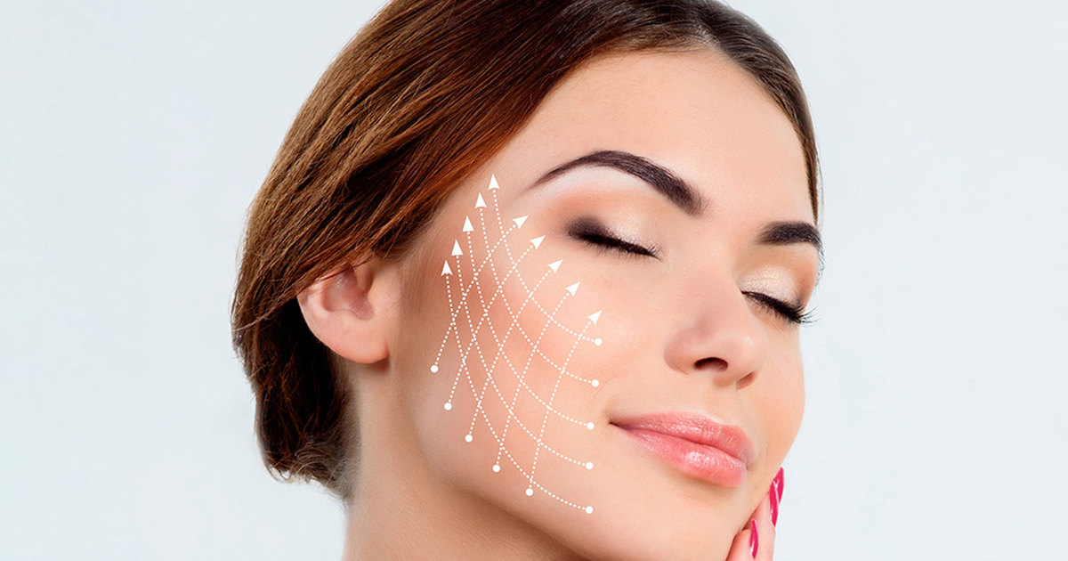 PDO Thread Lift Treatment for Facial Lift and Definition