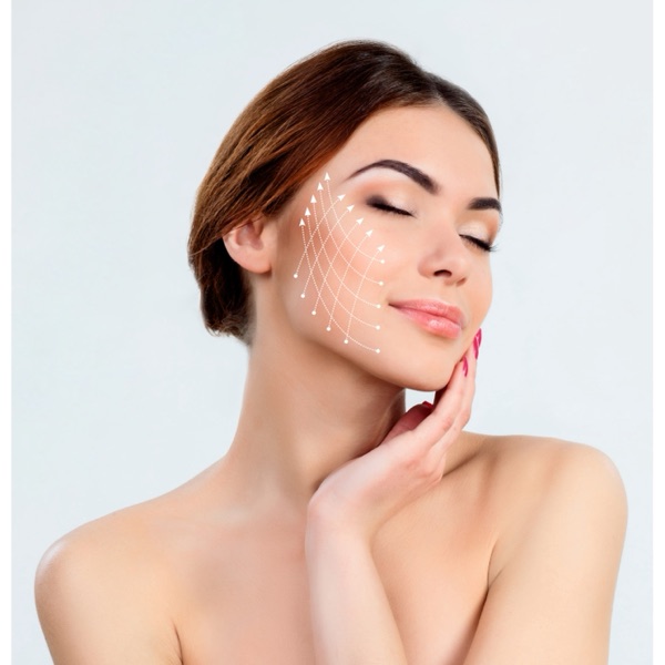 PDO thread lift for facial lift and definition