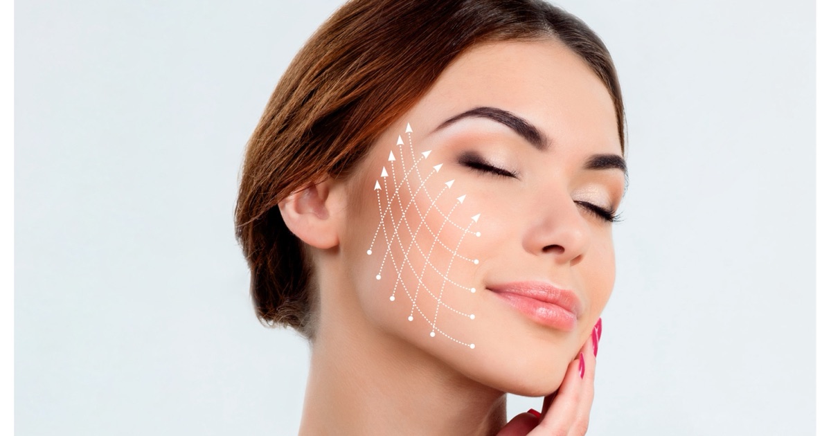 PDO thread lift for facial lift and definition